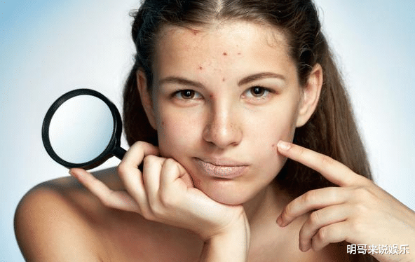 『痛风』女生脸上有斑点该如何去保养呢？
