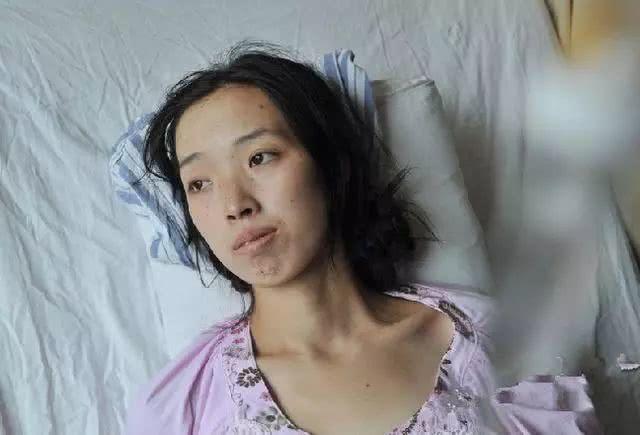 [胃癌]29岁女子，查出胃癌离世，医生叹息：都是自己“喝”出来的