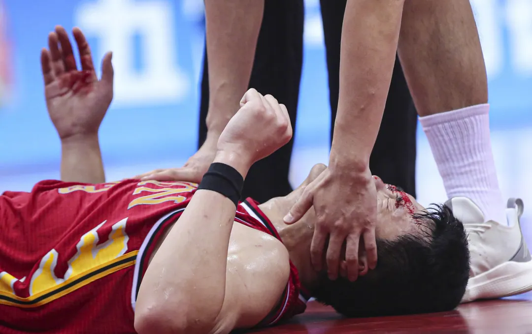 新疆男篮|?CBA最强状元血溅赛场担架出场！太恐怖血腥了！