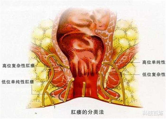【】专家：人类进化并不完全，身体还有6个“漏洞”，你知道几个？