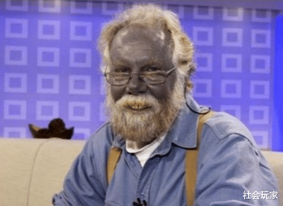 「」真实存在的“卫斯理”，蓝血人真的存在，他们生活在这里