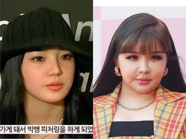 【朴春】整容上瘾？顶级女爱豆脸僵照片惊呆网友，还曾因涉毒被网暴四年