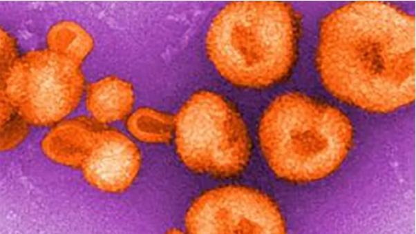 美國研究人員發現一種人傳人罕見病毒，暫時無特定藥物-圖2