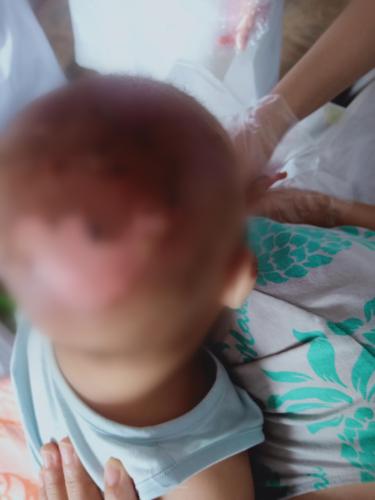 李岩|一家三口被烧伤，妻儿放弃治疗只求救丈夫，儿子才六个月