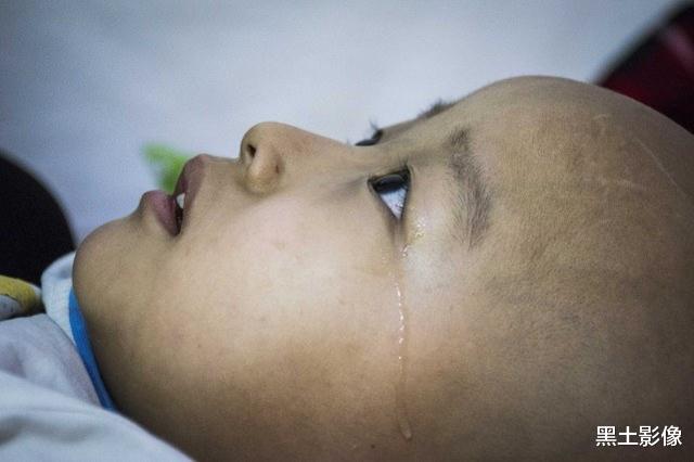 「医生」女子结婚12年不孕,试管婴儿喜得双胞胎,其中一个到3岁就出事了