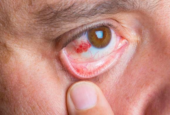 肝脏■肝病是拖出来的，提醒：身体出现一痒二痛三红，最好查下肝脏