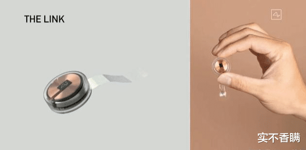 芯片|人脑装芯片变身“机器人”，2023年推向市场，成本几千美元