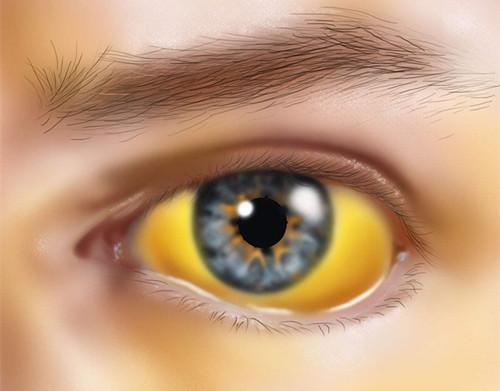 「肝脏」小心肝，肝脏不好，身体会给出这7个预警