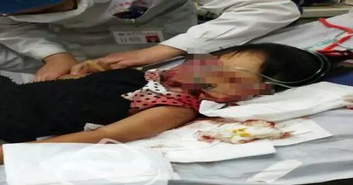沈阳新闻频道|持铁锹击打老人女童致1死1重伤 ，凶手已自杀身亡！警方最新通报来了