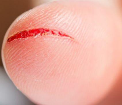 「长寿」寿命长的人，往往有\3快3通\的特点，占得越多，说明身体越健康