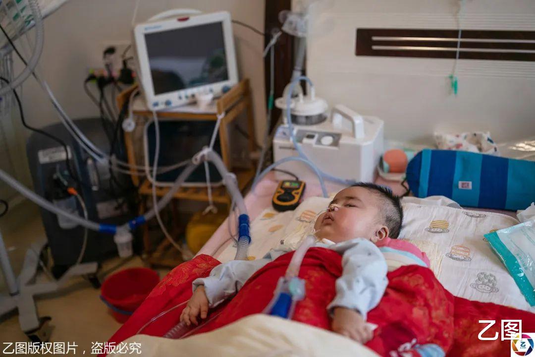 #诺西#一岁大眼男童患罕见病，只有眼珠能动，天价救命药70万元一针
