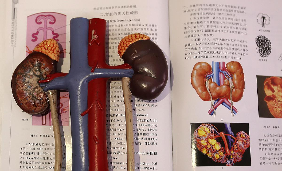 肾病|肾不好，4种食物要趁早拉黑，若你管不住嘴，肾病或许很难好