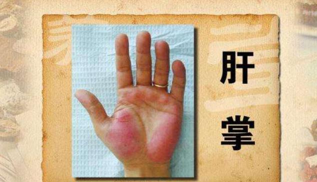 『肝脏』肝在变硬之前，身体可能会发出暗号，若你一个也没有，恭喜