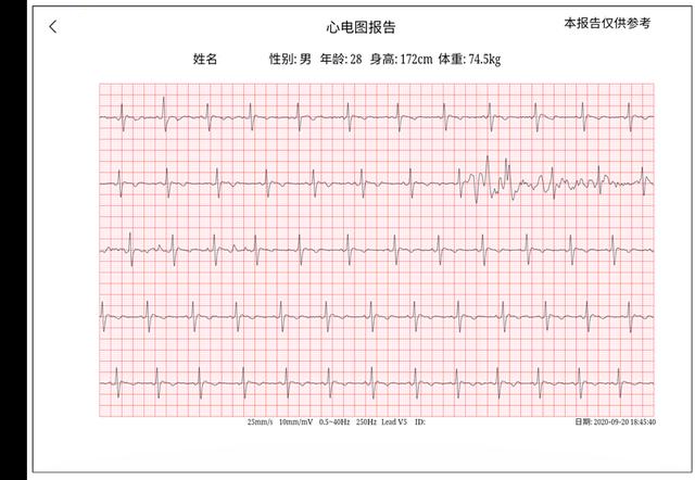 小米科技|小米推出黑科技T恤，智能心电测量，科学运动辅助，网友：未来感