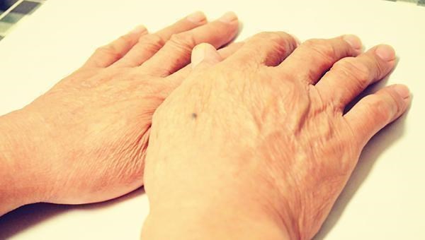 肝硬化|肝有病，手脚不会说谎，手脚如果有4个异常，肝硬化可能找上门了