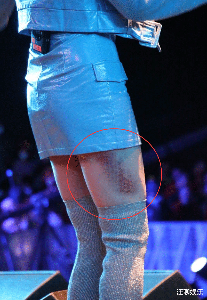 黄龄|黄龄刚摔下舞台，不到半小时又摔一个，主持人救场词堪称灾难