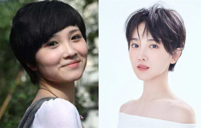 陈小纭|神仙整容！这要不说，谁知道陈小纭这张脸是做出来的？