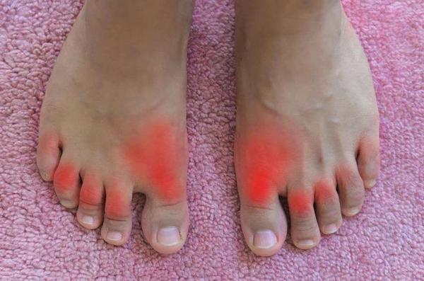 「痛风」尿酸高的人，四种食物再喜欢也要“管住嘴”，否则吃多少药都白搭