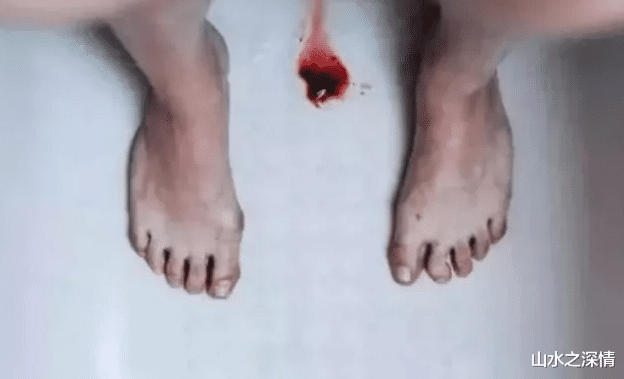 ▲女孩子来“例假”时，排出“红肉团”？无非是这3原因，请多加重视