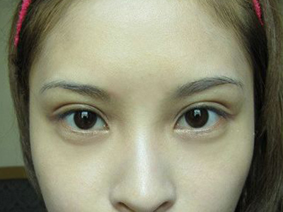 【睡眠】胃“不好”的人，脸上会出现“3迹象”，早就医别拖至“胃癌”来临