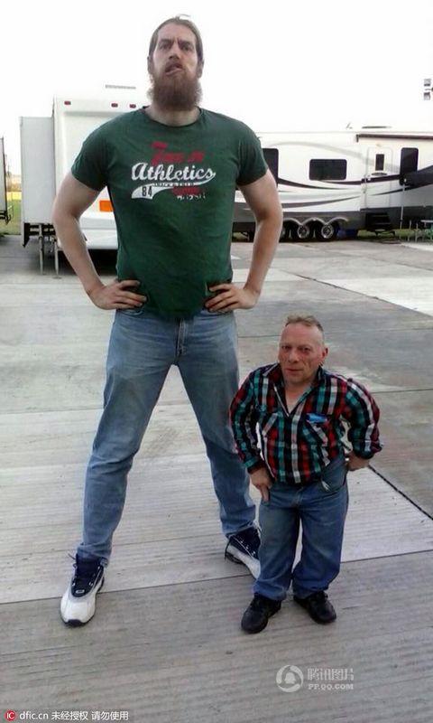 「侏儒症」人类史上唯一一例!奥地利一男子患上侏儒症后,又得巨人症