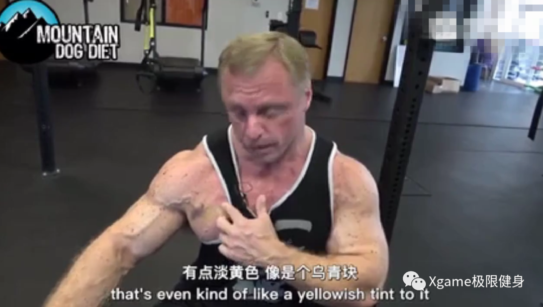 「胸肌」一张图告诉你，卧推胸肌撕裂到底多恐怖！