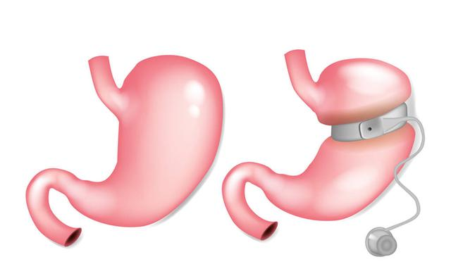 #黄芪#黄芪和它“天作之合”，坚持泡水喝，养肝护肾，气色红润显年轻