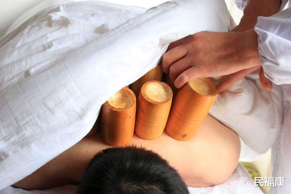 「拔火罐」拔火罐的好处有多少？后背留下的印子，是体内毒素多？涨知识了