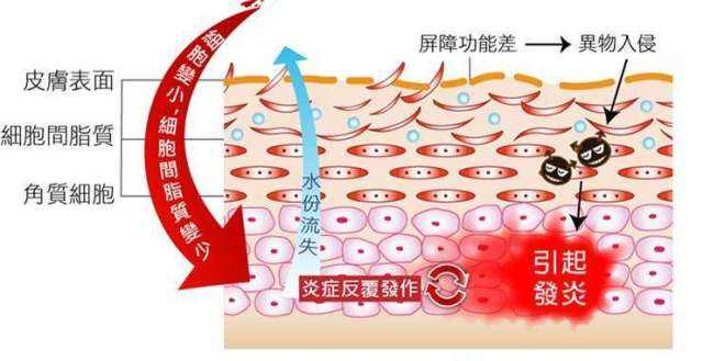 糖尿病|玻尿酸“失业了”！抗衰界“小米”问世，紧致提拉养成“女神脸”