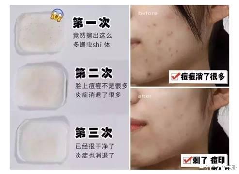 氨基酸▲自以为是在护肤，其实很“伤”皮肤的4种习惯，难怪皮肤一直不好