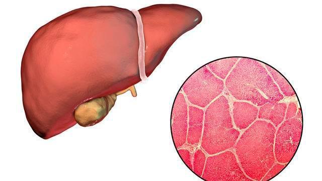 肝脏@肝不好，4类蔬菜要少吃！晨起没有这5个表现！说明肝脏很“轻松”