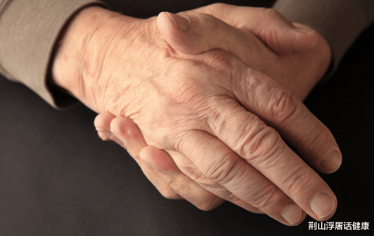 高血脂|甘油三酯升高，身上会出现3处异常，若没有，血管或算通畅