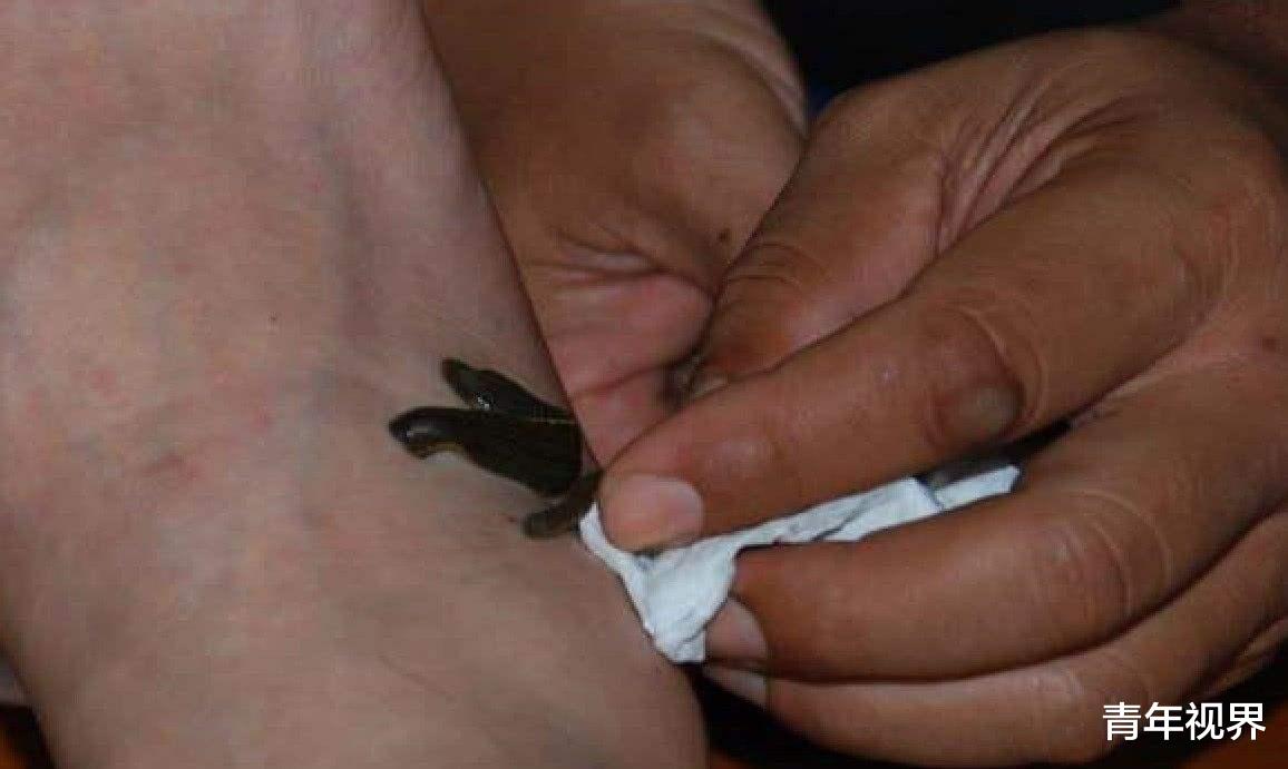 ##硫酸有多可怕?老外作死将水蛭扔进去,下一秒直接化成水!