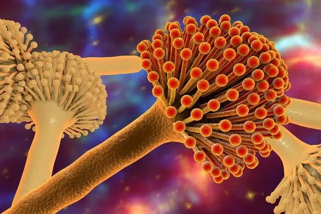 肝癌@50岁男子，查出肝癌，提醒：出现“1痣2臭”，快查查肝