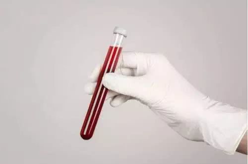 「肝功能」注意:检查肝功能之前,这几件事最好不要做,不然“白查了”!