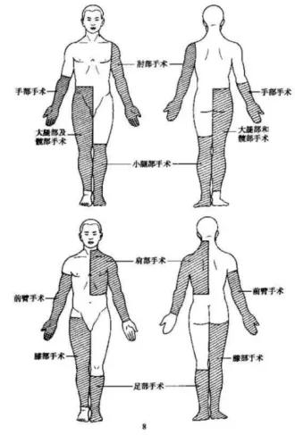 香坊@做个小手术,为什么却要脱光衣服和裤子?医生说出了真相