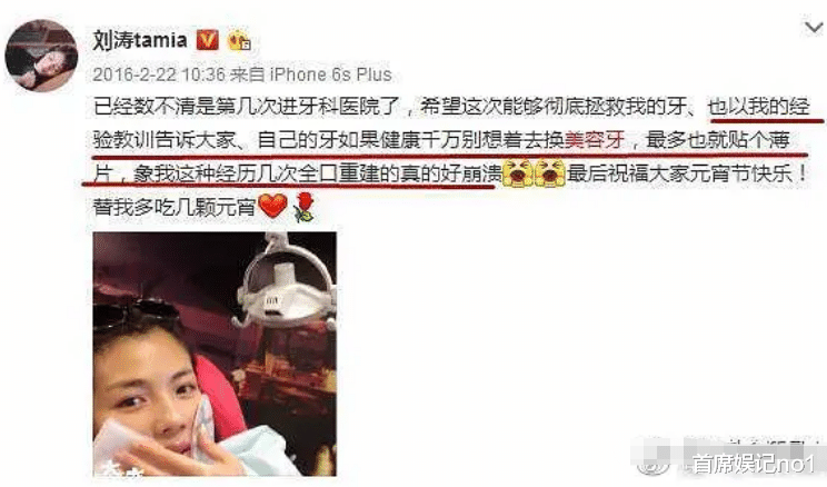 陈瑶|娜扎整牙之后颜值下滑，吴宣仪嘴都闭不上，陈瑶感觉人中长了一倍