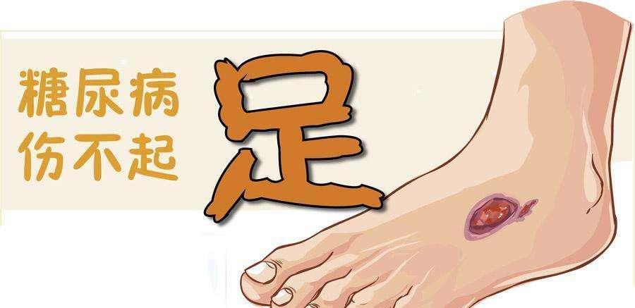 糖尿病|若糖尿病患者还是每天喝酒，可能身体要承受这两个恶果，要当心