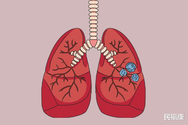 疾病|肺不好的人，身体会频繁“亮红灯”，一个都没有，肺养的还不赖