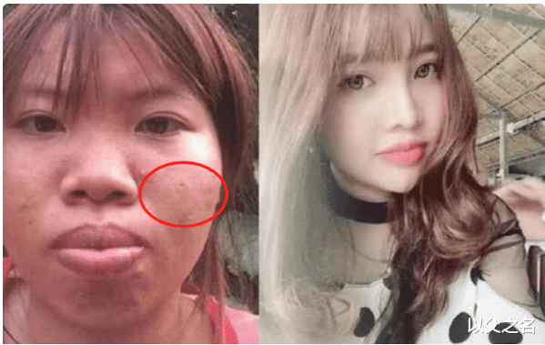 整容|越南第一丑女花10万整容,变美后被富豪狂追,孩子生下来富豪怒了