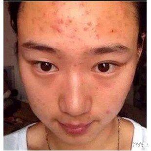 肝脏▲湿气重的人,脸上出现3种“情况”,请及时除湿,不要忽视