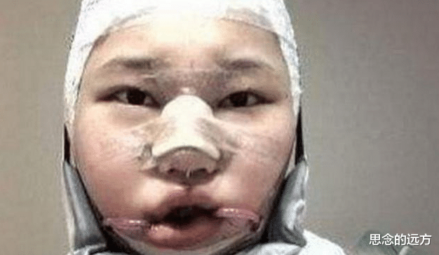 整容|女孩花百万整容，只为变成第二个“赵丽颖”，看到结果：复制粘贴？