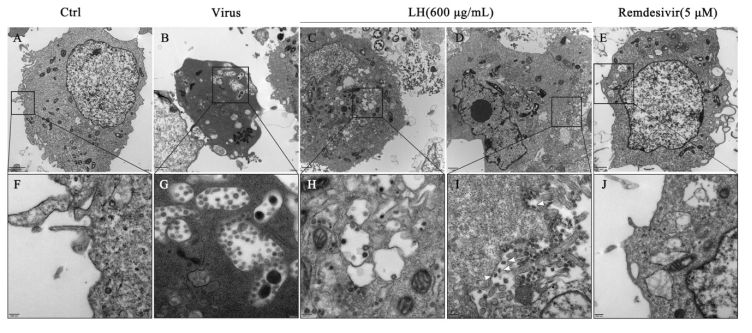 「冠状病毒」重大进展！连花清瘟胶囊对新型冠状病毒具有抗病毒抗炎作用