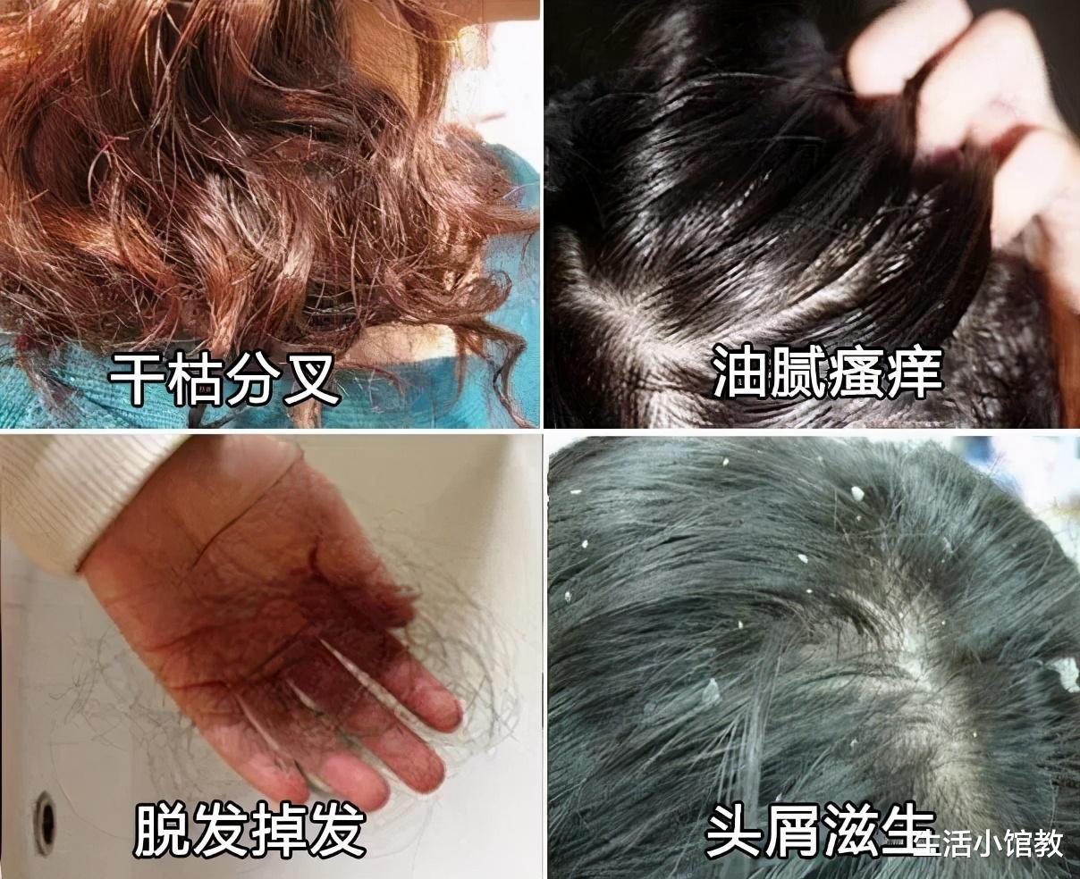 洗发水|央视曝光：这4种洗发水建议不要买，虽然销量高却存在很多问题