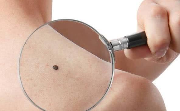 【长寿】长寿的人，通常身上3处会“发黑”，如果你也是，值得恭喜