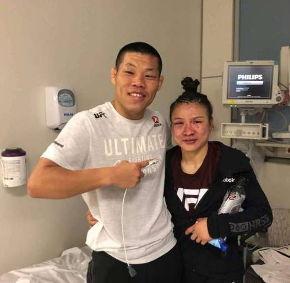 张伟丽晒自拍美颜照:我的小脸恢复的很好