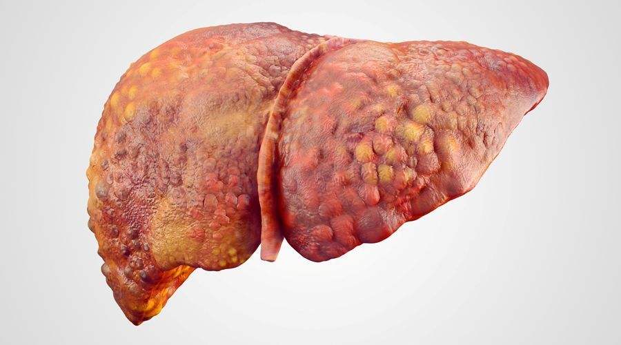 #肝脏#天然“护肝王”已找到,坚持泡水喝,修复肝细胞,提高肝功