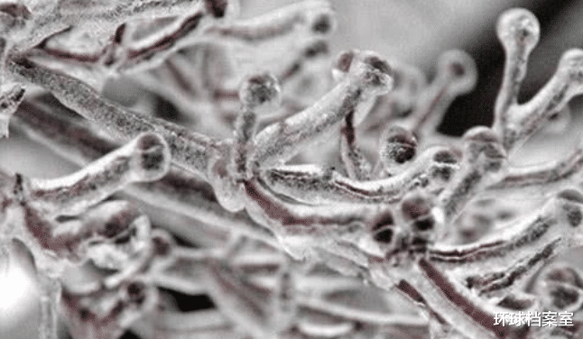 科学家|科学家为永生，和女模特一起注射350万年前细菌，2年后意外发生了