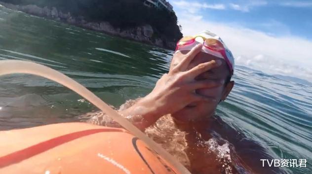 好痛呀！香港著名男星遊海泳時突遭海虱咬傷：整張臉都似被火燒-圖2