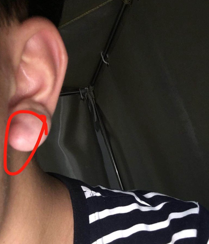 『饮食』身体有没有“瘀堵”，脸上4处一看便知，希望你1个也没占！